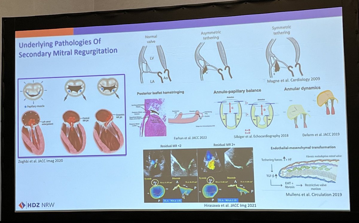 DrJMarine's tweet photo. Outstanding #MACCS keynote lecture by Dr. @VolkerRudolph1 on secondary MR: pathophysiology, medical treatment, TEER. Interesting analysis of disparities in TEER trial results and recent MATTERHORN trial. @ACCMaryland @DGK_org @sxz110 https://t.co/LytZvADifp