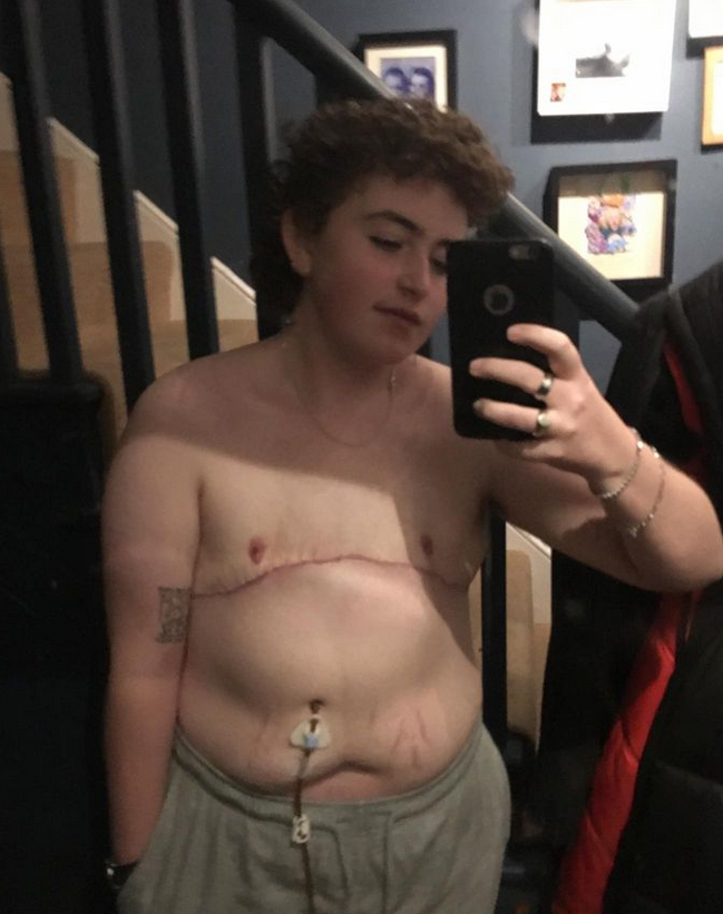 Holy shit. Nyní v populárním teenagerském seriálu Heartstoppers od Netflixu, protože podle wokeismu by tohle děti měly mít stále na očích. Je potřeba je bez ustání zpracovávat zábavnou formu.