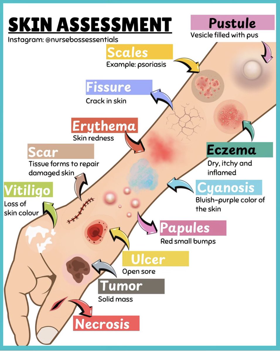DrMedica_13's tweet photo. Skin assessment ✨
•••
#MedEd #MedX #DermaMed https://t.co/mLMRfQJqL1