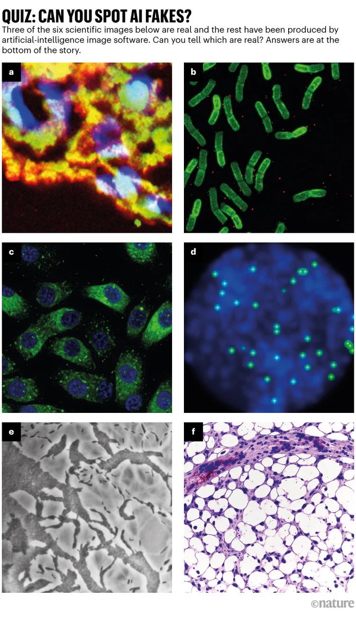 Natureに先週掲載された記事。画像生成AIの台頭により、科学の信憑性は如何に担保されるかという話。研究倫理が問われるものの、既に架空のAI論文は存在している事実…。

【Nature】AI-generated images threaten science - here's how researchers hope to spot them
https://t.co/Sms1sGc8ih 