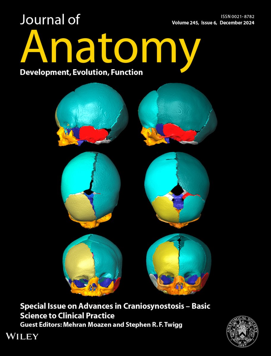 Our <a href="/MehranMoazen/">Mehran Moazen</a> is co-editor of the Dec 2024 issue of the Journal of #Anatomy, dedicated to various aspects of #craniosynostosis (kray-nee-o-sin-os-TOE-sis), where babies have a misshapen head, because fibrous skullbone joints prematurely closed. <a href="/MariusDidziokas/">Marius Didziokas</a> 
@UCL <a href="/ucl/">UCL</a>cdb