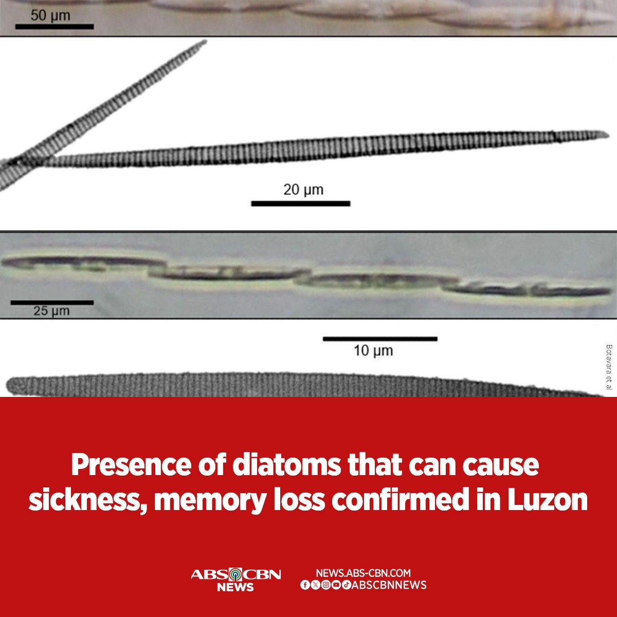 Researchers from the Philippines and Malaysia have confirmed the presence in Luzon of a type of microscopic algae called diatoms that can cause vomiting, diarrhea, abdominal cramps, and short-term memory loss that may be permanent.

READ: news.abs-cbn.com/lifestyle/heal…