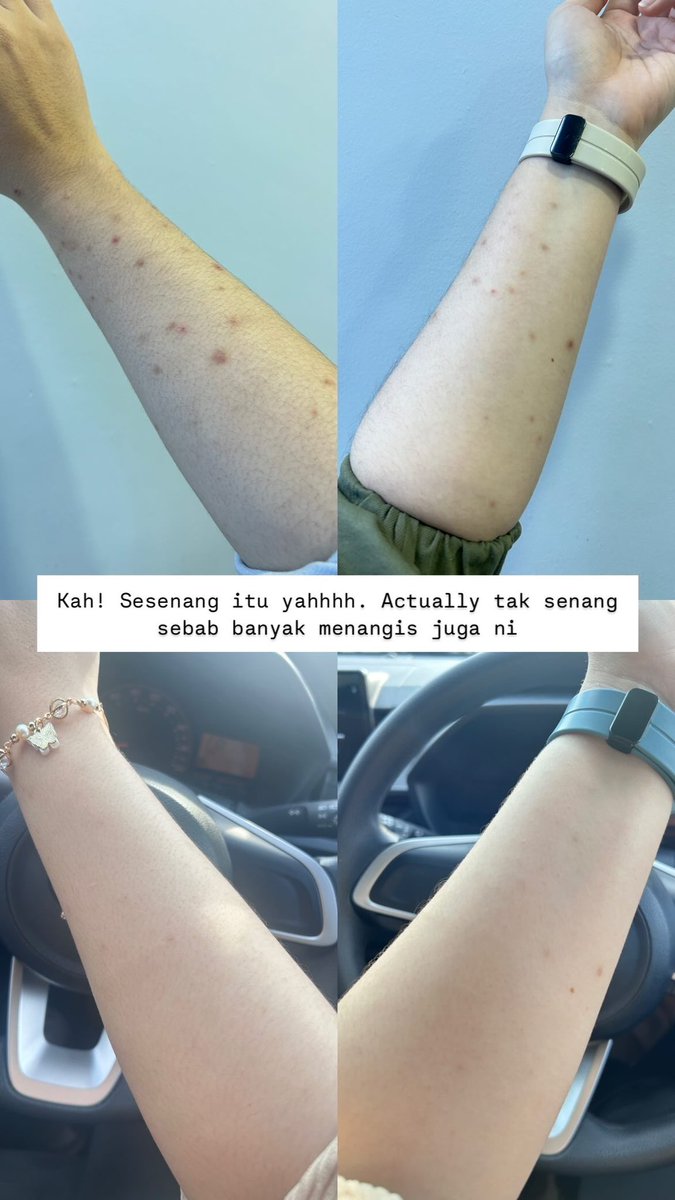 Finally! FINALLY! HILANG PUN PARUT AKU