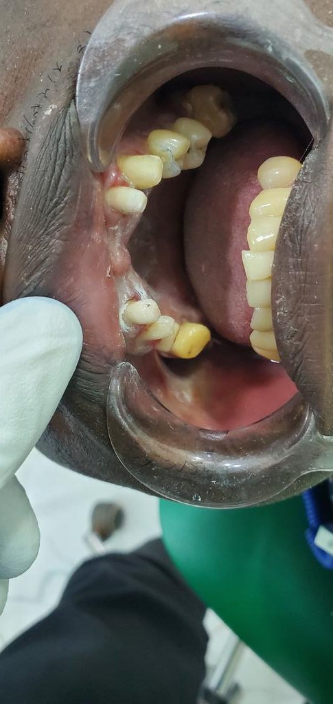 kasule_nasif's tweet photo. What are u waiting for. #healthsmiles #0703751724 book your appointment asap https://t.co/tJluOVuzLl