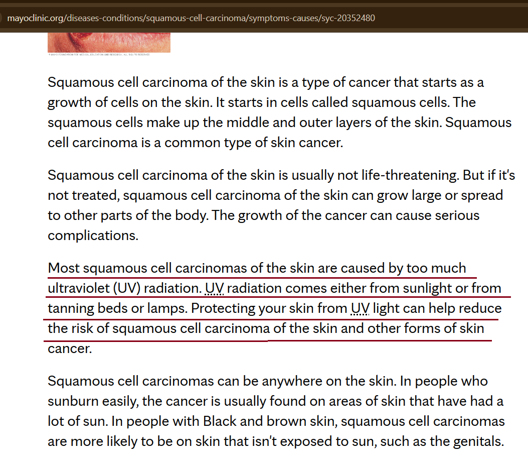 HealthScholarIN's tweet photo. 3-The case in point: (#PetticoatCancer) - is a form of skin cancer that develops due to a consistence irritation caused by tying something at the waist tightly.
In other words, almost every single attire - pants pajamas salwar, skirt - can cause this kind of irritation. Hence no specific role of the saree.