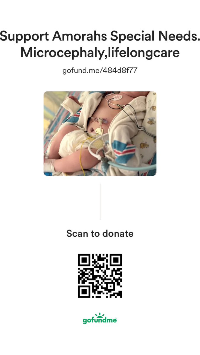My 3 month old daughter is #medicallyfragile #microcephaly (tiny head,skull bones overlapped and fused together surgery needed)most likely #blindchild enlarged aorta and #seizures . Im single mom on housing and need help. Please share,read #DonateOrShare #specialneeds #fundraiser