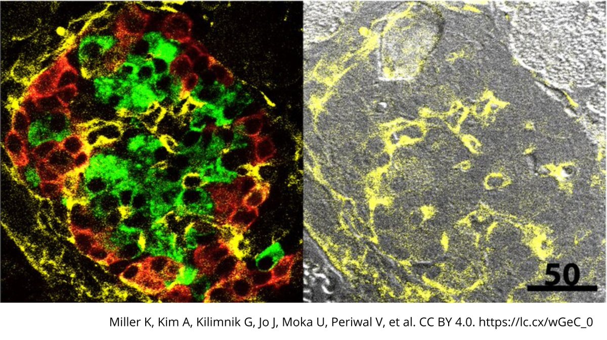 UBDivulga's tweet photo. Aquesta és una imatge d'una tinció immunohistoquímica d’un illot pancreàtic. Les cèl·lules tenyides de verd són les responsables de la secreció d'insulina, l'hormona clau en la regulació de la glucosa. #Mésquemil #DiaMundialDiabetis https://t.co/G6KvTDM3wO