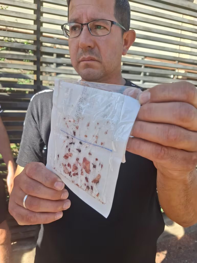 Dahiana Benitez perdió un ojo a consecuencia de que le tiraron un vaso de vidrio en un bar.

Mauricio Benitez, papá de Dahiana muestra los restos de vidrios que sacaron del ojo de su hija.

El que arrojó el vaso de vidrio sería Eliam Fernando Tomás López Torres.