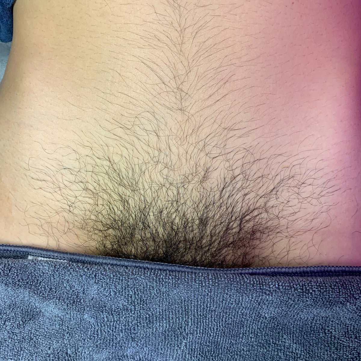 ✓ 남자 원장님의 1:1 맞춤 예약 관리
✓ 호주 명품 라이콘 하드 &amp; 소프트 왁스
✓ 시술 후 모든 기구, 용품 소독 및 1회 용품 사용
✓ 샤워실 완비
​✓ 당일 예약 가능

 문의 : open.kakao.com/o/sXF03Mzf

#인천남자왁싱 #인천남자왁서 #송도 #청라 #부평 #주안