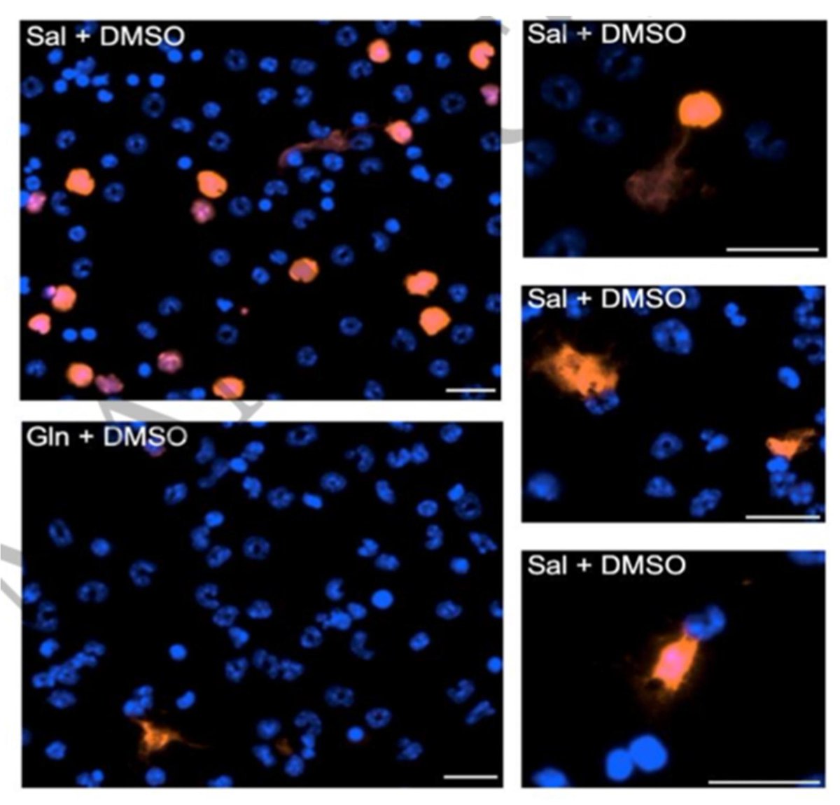 Sreeparna Banerjee (@sreeparna_b) on Twitter photo Last week's papers on #glutamine #cancer and #metabolism via <a href="/Bims_BiomedNews/">Bims: Biomed News</a>
biomed.news/bims-glucam/20…
Top pick: Glutamine modulates neutrophil recruitment and effector functions during sterile inflammation pubmed.ncbi.nlm.nih.gov/39504570/ Last week's papers on #glutamine #cancer and #metabolism via <a href="/Bims_BiomedNews/">Bims: Biomed News</a>
biomed.news/bims-glucam/20…
Top pick: Glutamine modulates neutrophil recruitment and effector functions during sterile inflammation pubmed.ncbi.nlm.nih.gov/39504570/