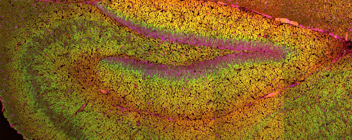 Alomone Labs (@alomone_labs) on Twitter photo Mouse brain reveals secrets! ✨ This #MicroscopeMonday shows P/Q-type Ca2+ channels (green) & their blocker (red) in the dentate gyrus. It's linked to migraines & more! Learn about multiplex immunodetection: alomone.com/multiplex-immu…
<a href="/zeiss_micro/">ZEISS Microscopy</a> #neurotwitter #microscopy Mouse brain reveals secrets! ✨ This #MicroscopeMonday shows P/Q-type Ca2+ channels (green) & their blocker (red) in the dentate gyrus. It's linked to migraines & more! Learn about multiplex immunodetection: alomone.com/multiplex-immu…
<a href="/zeiss_micro/">ZEISS Microscopy</a> #neurotwitter #microscopy