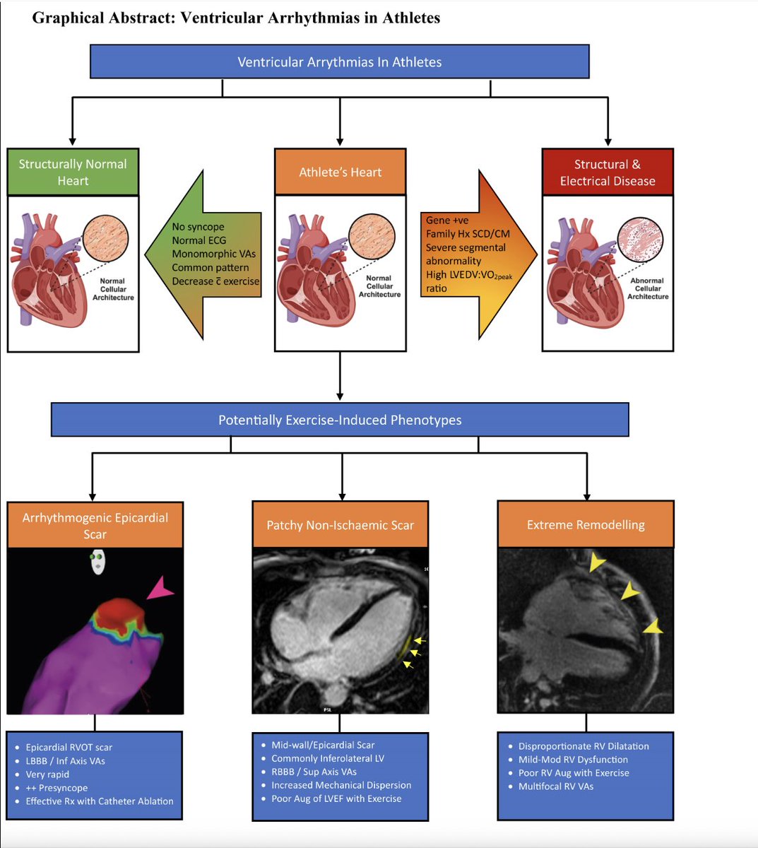 LAHRS (@lahrsonline1) on Twitter photo Ventricular arrhythmias in association with athletic cardiac remodelling
Review #EUROPACE <a href="/ESC_Journals/">European Society of Cardiology Journals</a>
"It is unclear whether the ‘athlete’s heart’ promotes specific arrhythmias or whether it represents a more general pro-arrhythmogenic phenotype"
academic.oup.com/europace/advan… Ventricular arrhythmias in association with athletic cardiac remodelling
Review #EUROPACE <a href="/ESC_Journals/">European Society of Cardiology Journals</a>
"It is unclear whether the ‘athlete’s heart’ promotes specific arrhythmias or whether it represents a more general pro-arrhythmogenic phenotype"
academic.oup.com/europace/advan…