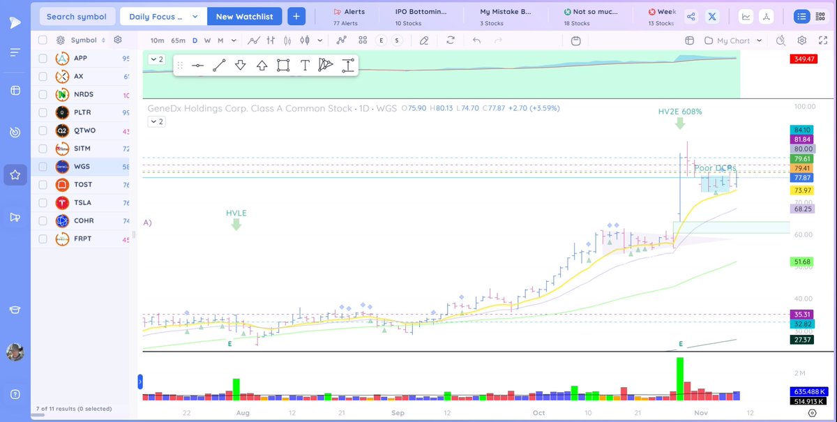James_Weyer_'s tweet photo. $WGS Possible buy @ BO from range. #GeneDx https://t.co/xm5Rw8LquV