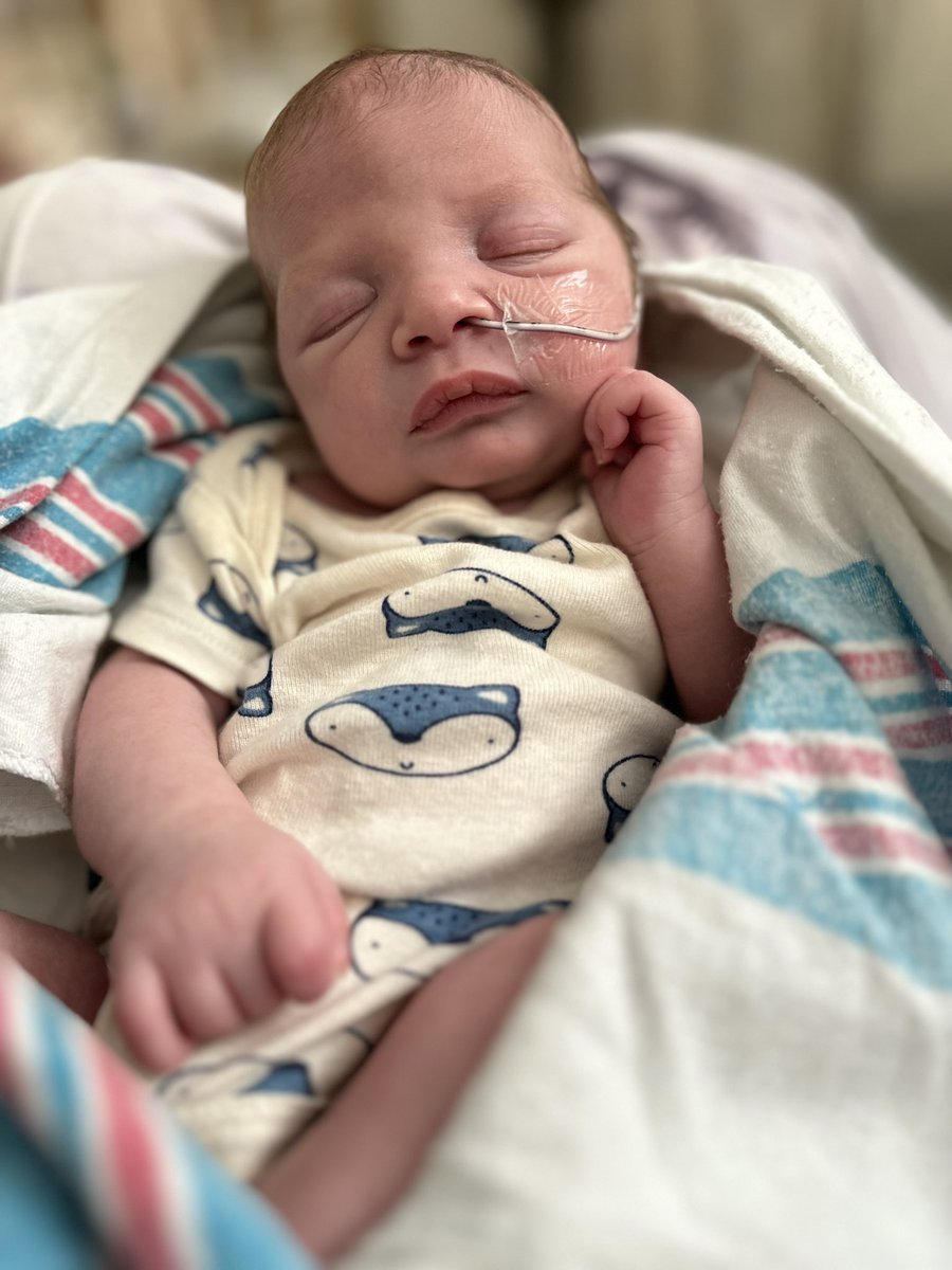 My 3 month old has #microcephaly #blind #gtube #medicallyfragile and will need lifelong care. Anything will help. I am still processing all of this as I am doing this by myself with no support and I have a 7 year old as well. #gofundme bc I’m pretty desperate. God bless and thank