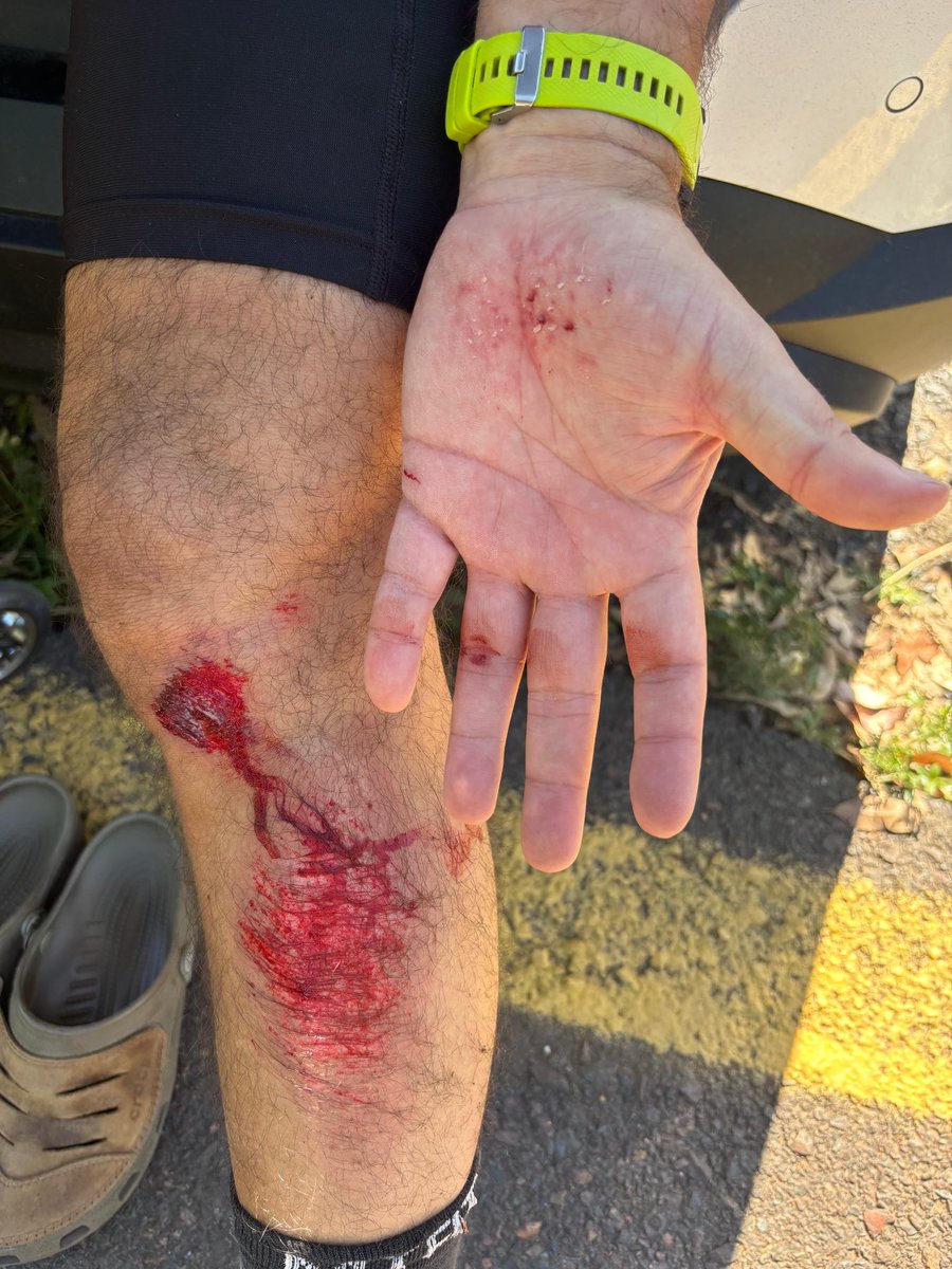 hardbiker_py's tweet photo. de las acciones realizadas y los accidentes sufridos en el
Parque. https://t.co/HRMu4j3587