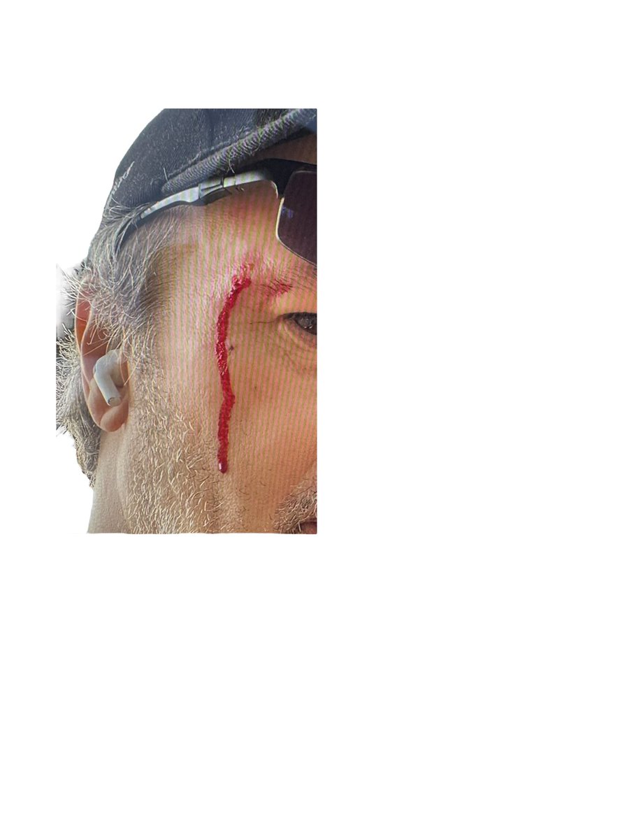 hardbiker_py's tweet photo. de las acciones realizadas y los accidentes sufridos en el
Parque. https://t.co/HRMu4j3587