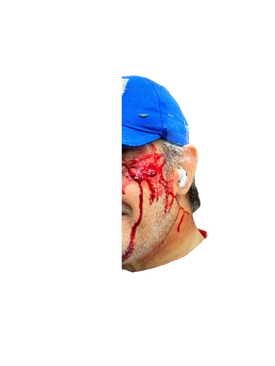 hardbiker_py's tweet photo. de las acciones realizadas y los accidentes sufridos en el
Parque. https://t.co/HRMu4j3587