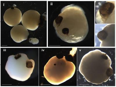 FinancialLillie's tweet photo. Scientists have created brain ‘organoids’ that may be showing early signs of sentience. Should that give researchers pause? https://t.co/0hXKPb6vV7 https://t.co/MFXXmN8WLR