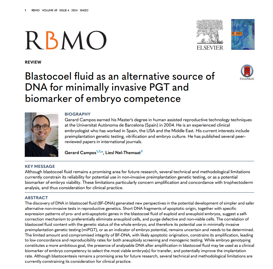 Reproductive BioMedicine Online (@rbmonline) on Twitter photo This review article highlights technical and methodological limitations constraining the clinical use of PGT based on blastocentesis.
It recommends prospective studies refine the technique and enhance the predictive power of the BF-DNA amplification. 
 
doi.org/10.1016/j.rbmo… This review article highlights technical and methodological limitations constraining the clinical use of PGT based on blastocentesis.
It recommends prospective studies refine the technique and enhance the predictive power of the BF-DNA amplification. 
 
doi.org/10.1016/j.rbmo…