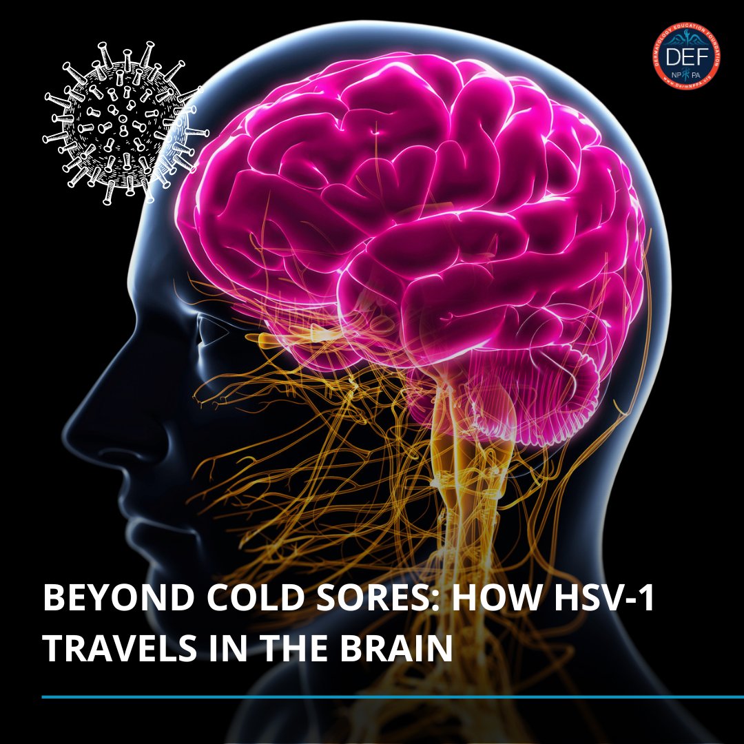 DermNPPA's tweet photo. New research links HSV-1 to potential neurodegenerative impacts like Alzheimer’s. It maps HSV-1's path through the central nervous system, affecting regions for sleep, movement, and mood, with microglia inflammation as a key factor. https://t.co/YhHsZTnQPK