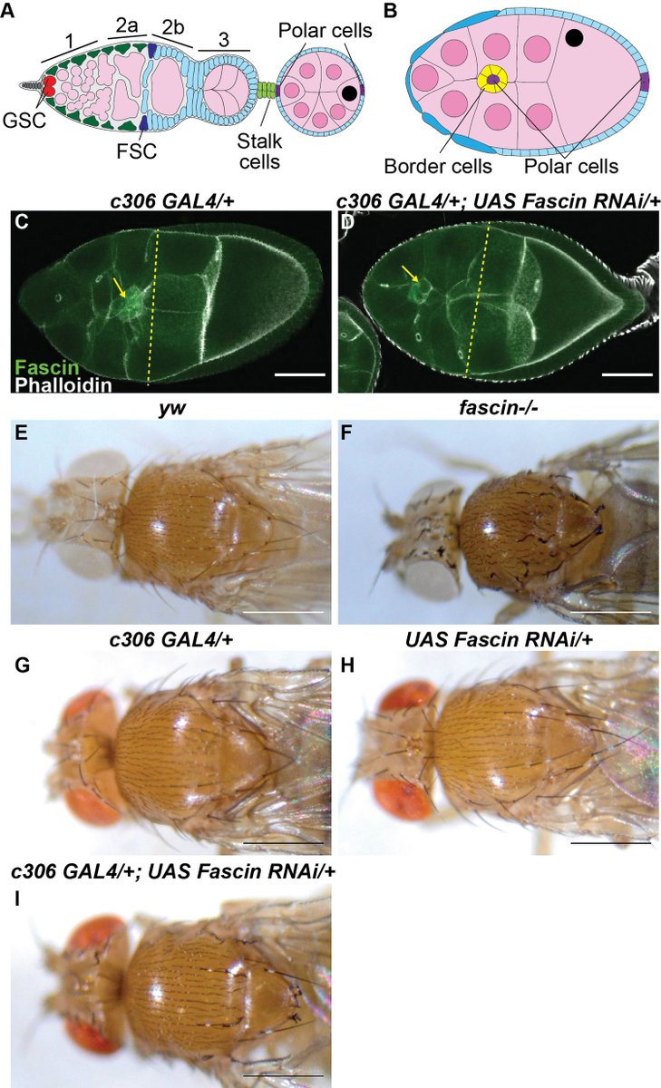Micropub7n's tweet photo. Drosophila melanogaster c306 GAL4 is not specific to ovarian cells #micropublication #biology #data #caltechlibrary #Drosophila #ExpressionData #PhenotypeData #NewFinding https://t.co/6tOUXvWGn0 https://t.co/HCr7DBY1yE