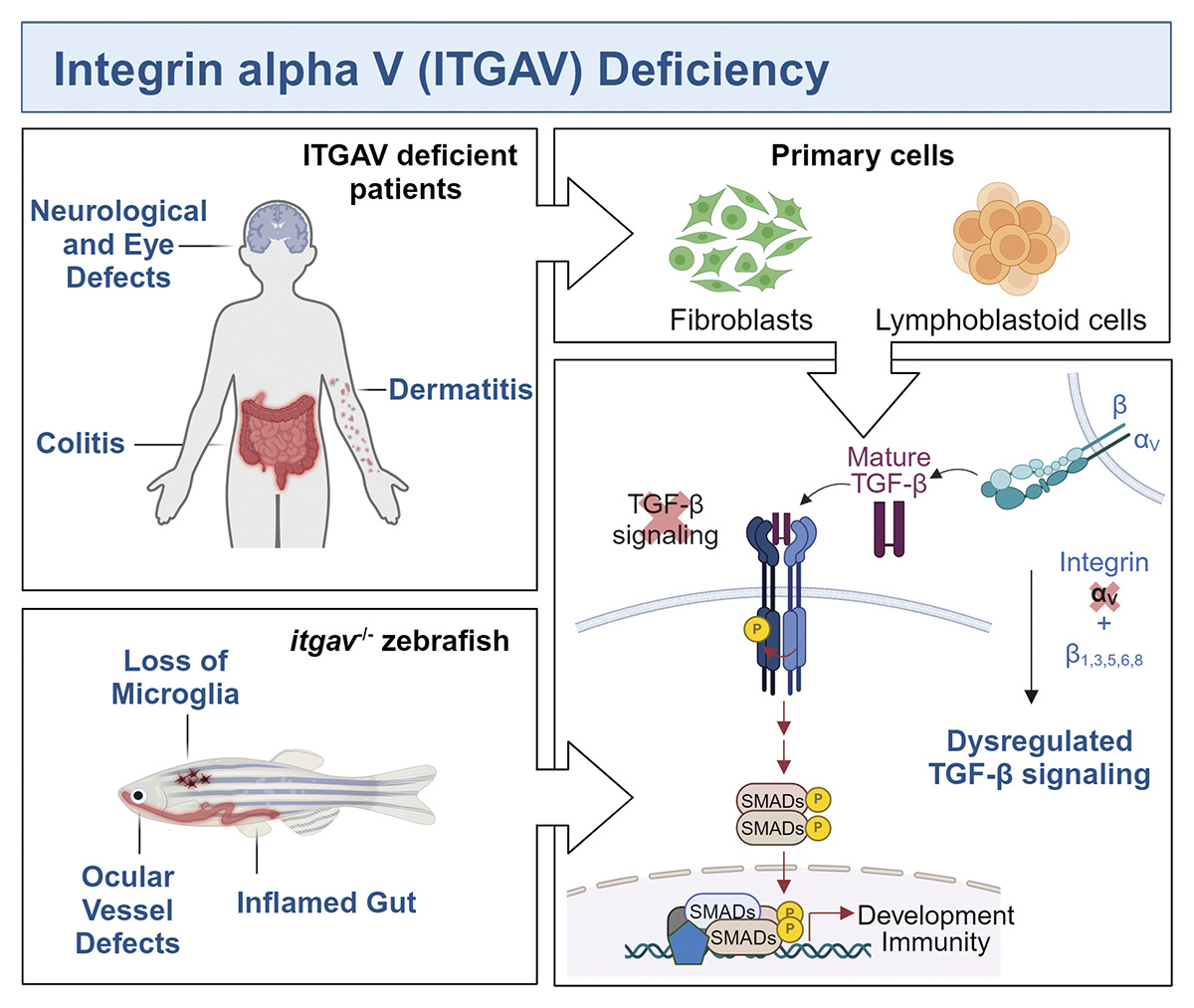 Journal of Experimental Medicine (@jexpmed) on Twitter photo Ghasempour et al. <a href="/SickKidsNews/">The Hospital for Sick Children (SickKids)</a> use whole exome sequencing in #IBD patients to reveal variant of ITGAV that impair #integrin function, including downstream TGF-β signaling, as determined in patient cells and modeled in zebrafish. hubs.la/Q02XKzWX0
<a href="/rodari_marco/">Marco Rodari</a> @marparl1 Ghasempour et al. <a href="/SickKidsNews/">The Hospital for Sick Children (SickKids)</a> use whole exome sequencing in #IBD patients to reveal variant of ITGAV that impair #integrin function, including downstream TGF-β signaling, as determined in patient cells and modeled in zebrafish. hubs.la/Q02XKzWX0
<a href="/rodari_marco/">Marco Rodari</a> @marparl1