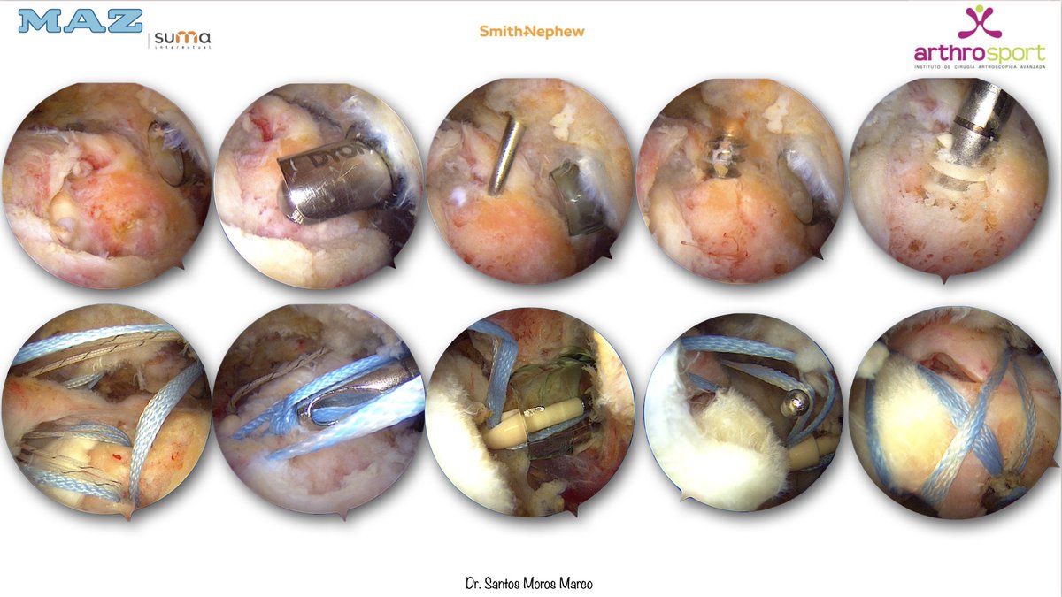 Dr. S. Moros Marco tweet media