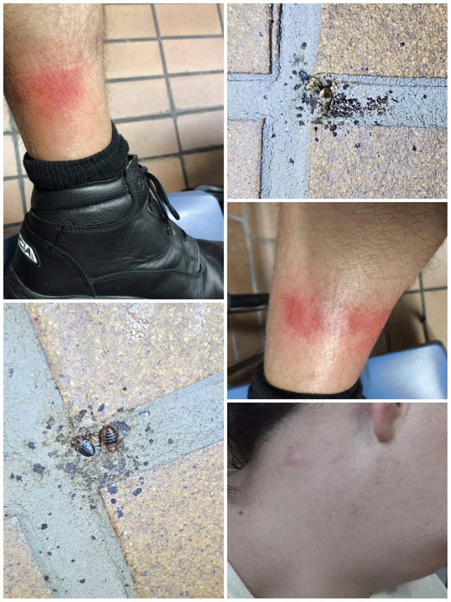 AlicanteCEP's tweet photo. 😡😡Lo avisamos el otro día @interiorgob y ya ha vuelto a suceder, picaduras de chinches a Policías y detenidos un día más en la Comisaría Provincial de #Alicante
 Se acabó.
@ITSS_INSPECCION
@sanidadgob
La gestión una vez más se demuestra que es pésima.
Abandonados por @info_dgp https://t.co/jiEKv5unVz