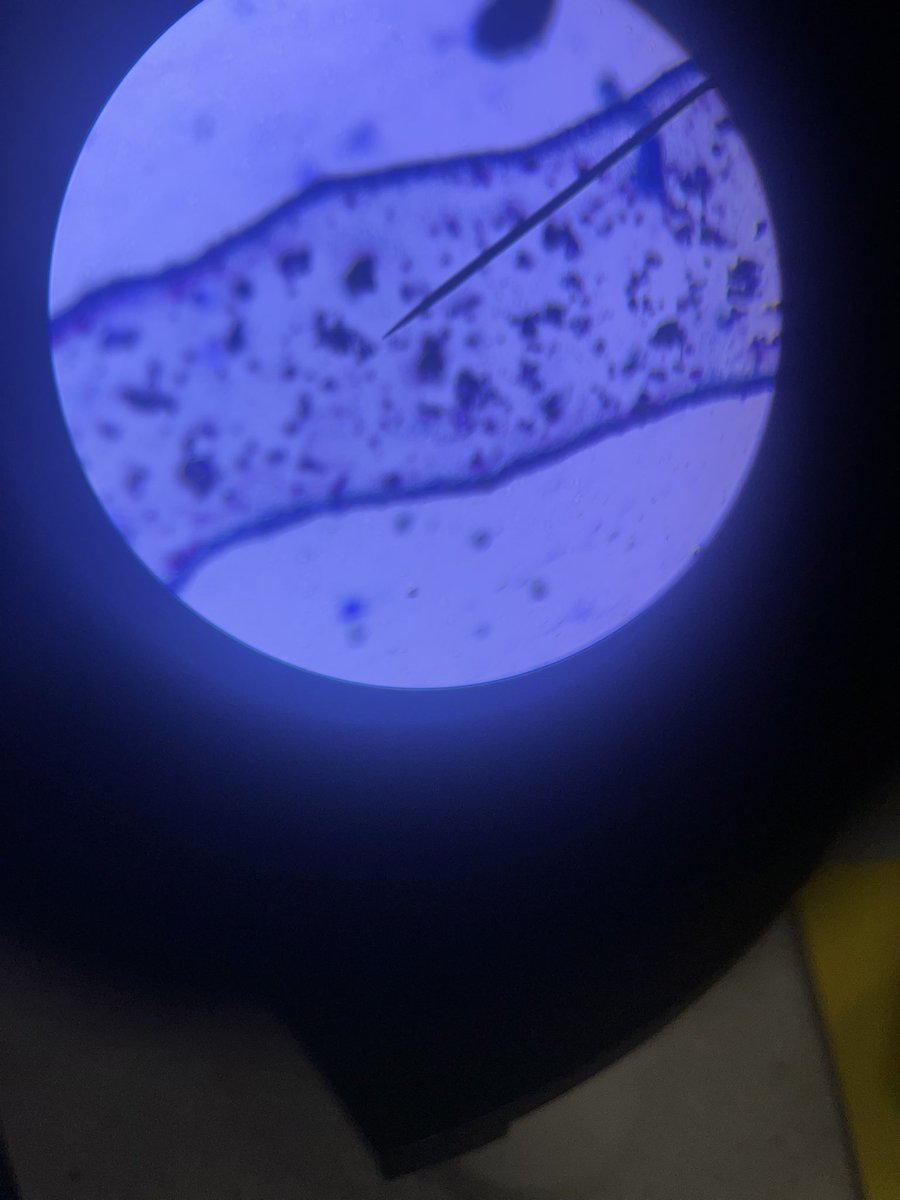 Marsh5Miss's tweet photo. Year 7 cheek cells practical. They absolutely loved it!! https://t.co/PnbtNqbWI0