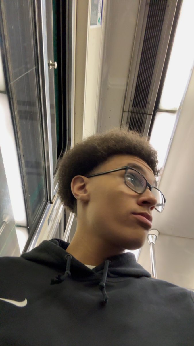 Hair transplant went good