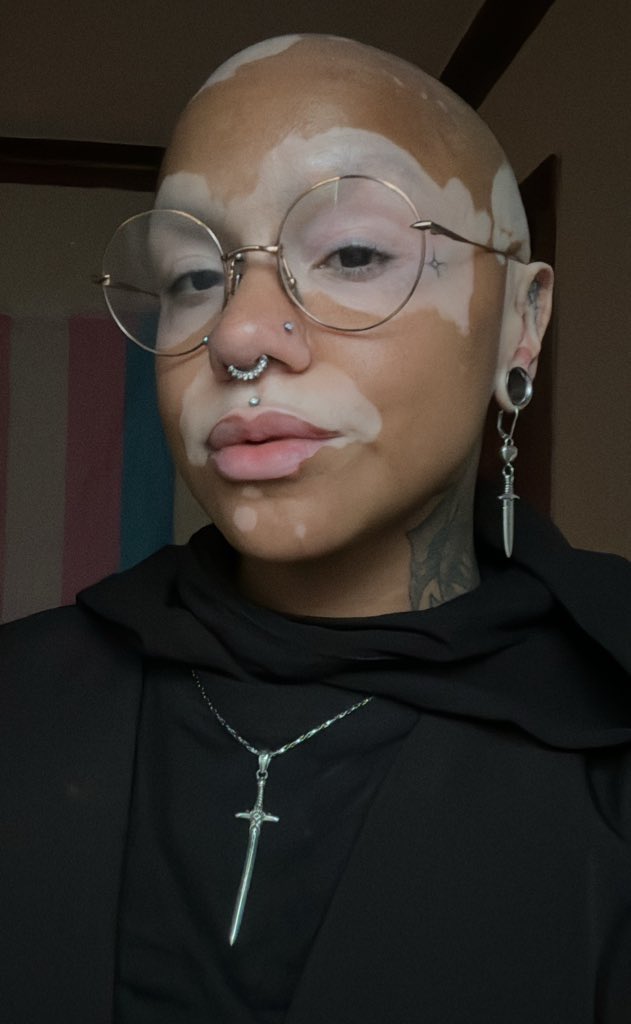 🩸 𝔱𝔥𝔢𝔢 𝔪𝔲𝔤 𝔬𝔣 ℭ𝔥𝔦𝔠𝔞𝔤𝔬 🩸 tweet media