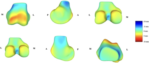 Rabeeh Majidi, Ph.D. (@rabeeh_m) on Twitter photo A <a href="/JOrthopRes/">Journal of Orthopaedic Research®</a> study reveals how normal #aging impacts #knee shape without #osteoarthritis. Using 3D modeling of CT scans, researchers found age-related changes like femoral bone volume increase and tibial plateau expansion.<a href="/ORSsociety/">Orthopaedic Research Society</a> #ORSSMC doi.org/10.1002/jor.25… <a href="/DiPerriman/">DIANA PERRIMAN (Dr, she, her)</a> A <a href="/JOrthopRes/">Journal of Orthopaedic Research®</a> study reveals how normal #aging impacts #knee shape without #osteoarthritis. Using 3D modeling of CT scans, researchers found age-related changes like femoral bone volume increase and tibial plateau expansion.<a href="/ORSsociety/">Orthopaedic Research Society</a> #ORSSMC doi.org/10.1002/jor.25… <a href="/DiPerriman/">DIANA PERRIMAN (Dr, she, her)</a>