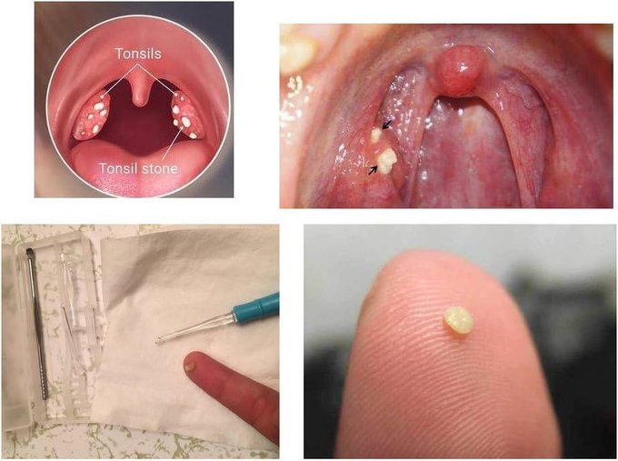 أسباب رائحة الفم الكريهة المرتبطة بالمعدة والجهاز الهضمي 
بسردها لكم أسفل التغريدة 

لو مشغول فضلها وارجع لها بعدين 🤍