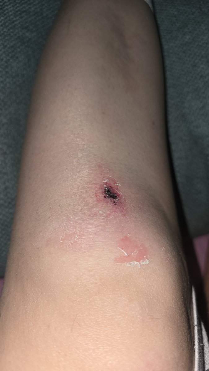 Kathyjue's tweet photo. @Banobras_mx toda su basura que dejó en el camino su camión, me provocó un accidente en Insurgentes Sur bajo puente, antes de llegar a La Raza, ¡pongan más cuidado! Lo reporté al 911 porque estaban a punto de que hubiera una carambola. Esto, en la mañana. https://t.co/7BCK3PkTdn