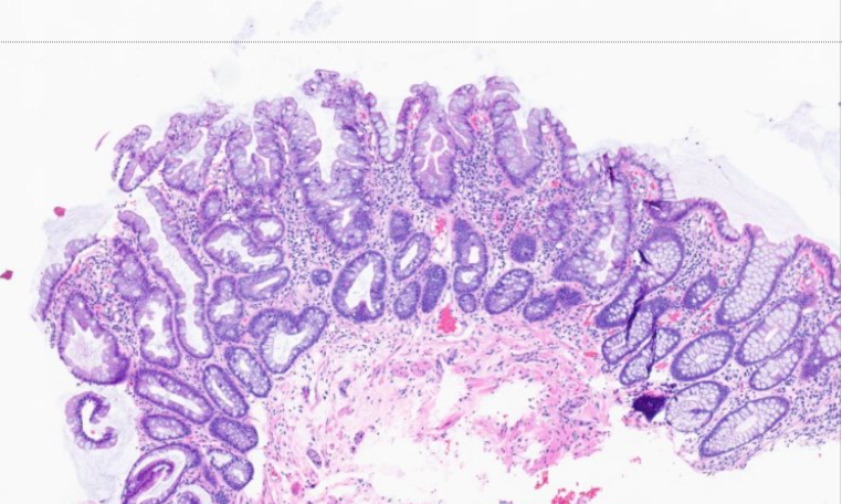 A. Sarah Erem tweet media