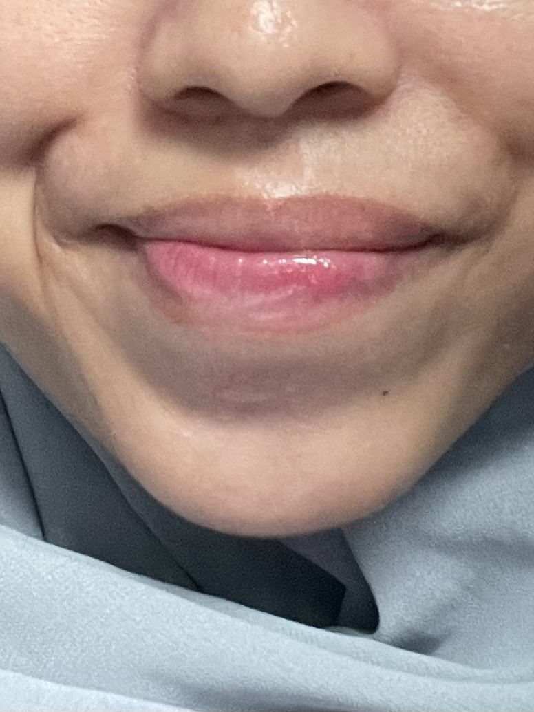 coffeeorcola's tweet photo. 👄a thread of my lip care routine for healthy lips👄

•Hygr Tinted Lip Balm
•Skintific Brightening Lip Serum 
•Emina Lip Mask
•Emina Watercolor Lip Serum
•Mediheal Sleeping Mask
•Mediheal Balm

REVIEW👇 https://t.co/HwWXsuWvE9