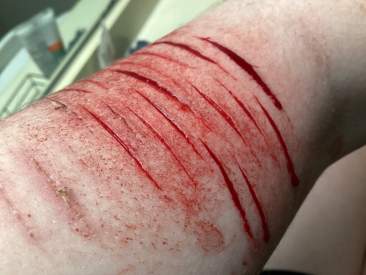 Pezshtwt's tweet photo. Hehe- I’M GETTING WORSE~! >.< #shtwt #sh #suicidal #styros #deepstyros #styrofoam #babybeans #beans #988twt #cvts #ouchietwt #ouchie #slittwt https://t.co/yimU5RBoJy