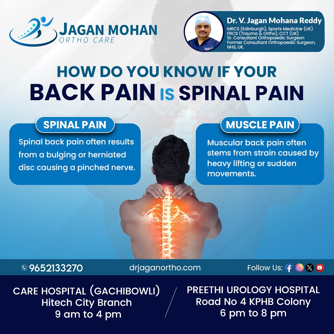 JaganOrthopedic's tweet image. Back pain is often linked to spinal issues, affecting mobility and quality of life. 

Book your appointment now
Call: 9652133270
#drjaganortho #hitechcity #kphp #BackPain #SpinalPain #SpineHealth 

visit
drjaganortho.com
