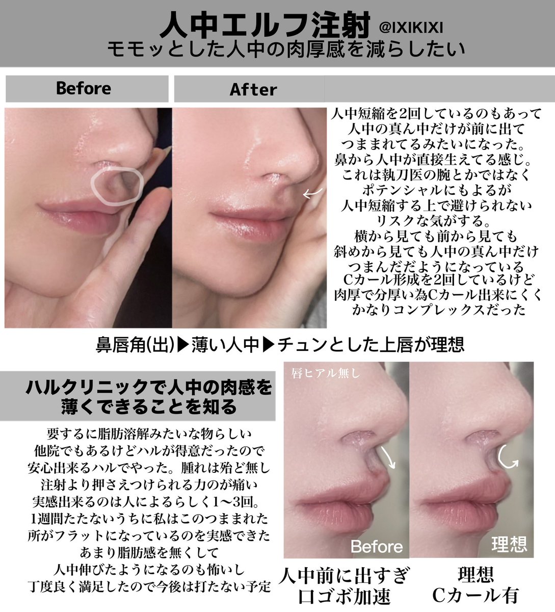 河崎 ジュリ ┊💉整形人生. tweet media