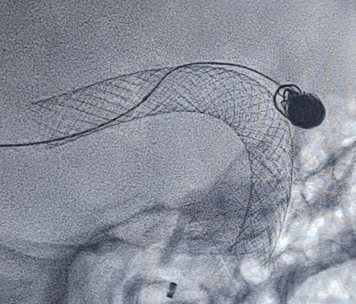 Dr Sharath Kumar G tweet media