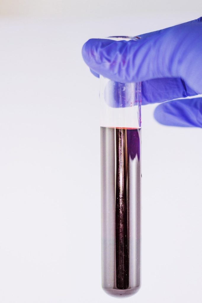 Signs of multiple sclerosis show up in blood years before symptoms.
patienttalk.org/signs-of-multi…