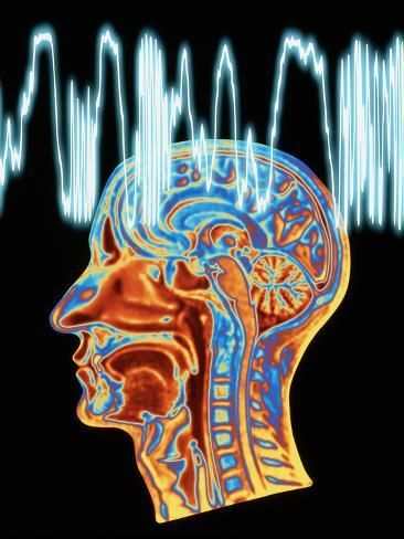 La terapia somática es la mejor manera de reprogramar el cerebro para liberarlo de la ansiedad, curar los traumas acumulados y calmar el sistema nervioso del estrés.  

A continuación, se incluye todo lo que necesitas saber al respecto: 🧵