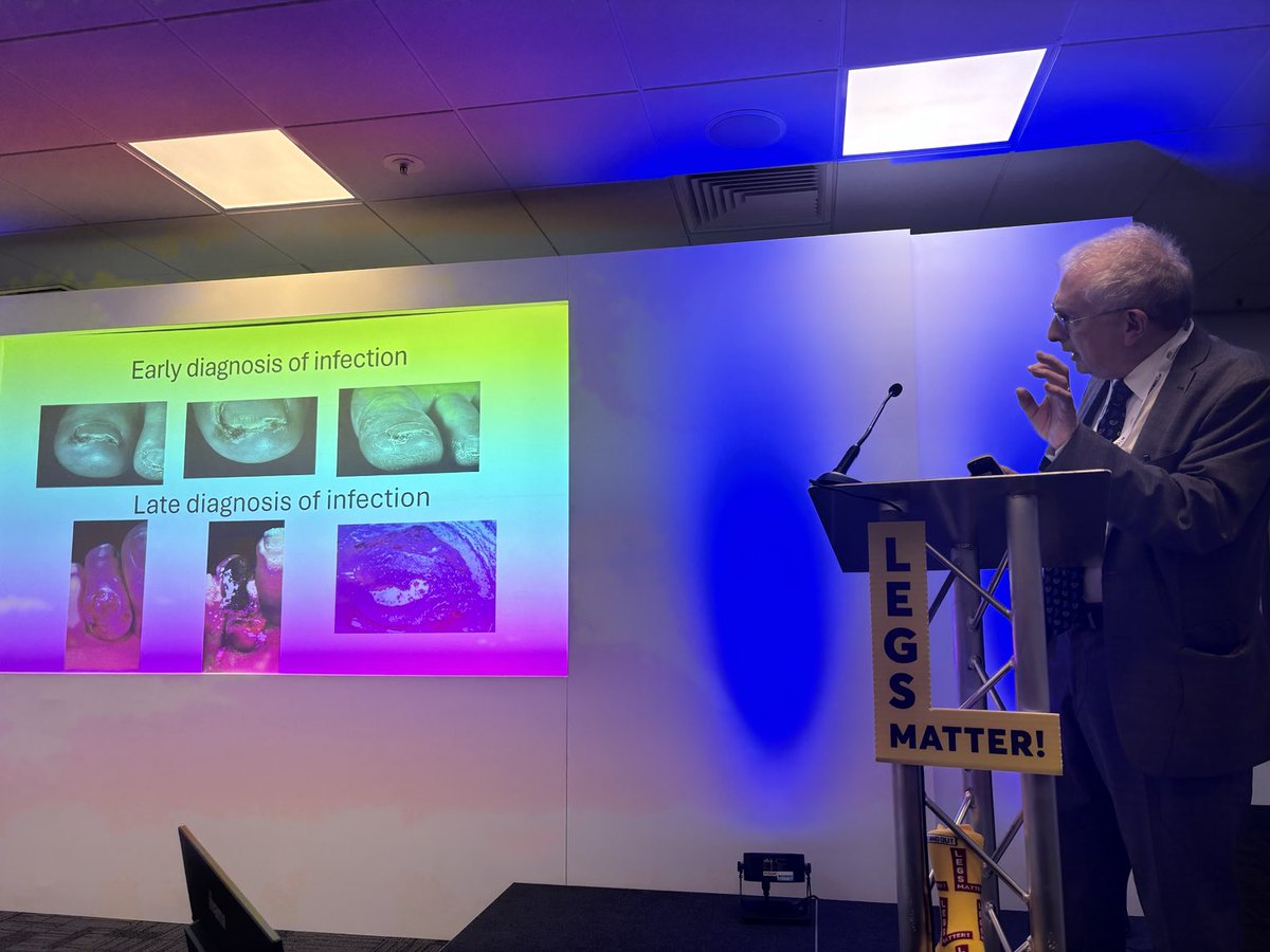 Prof Mike Edmonds starting off the #FDUK25 ⁦<a href="/footindiabetes/">Foot In Diabetes UK</a>⁩ conference in Harrogate and launching the infection consensus document ⁦<a href="/Wounds_UK/">Wounds UK</a>⁩