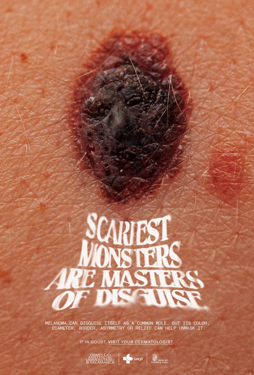 creapills's tweet photo. “Les monstres les plus effrayants sont des maîtres du déguisement” – Une campagne de prévention sur les mélanomes qui fait froid dans le dos. https://t.co/3dCCZzGS6d
