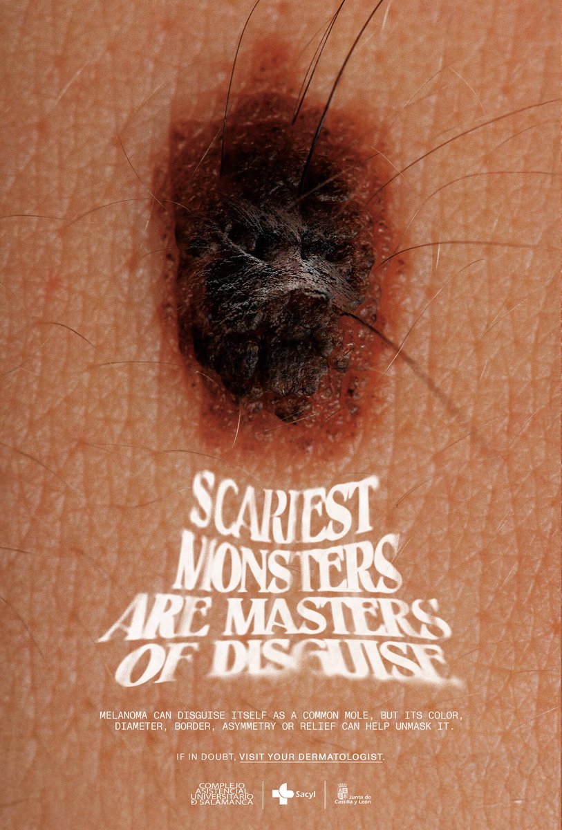 creapills's tweet photo. “Les monstres les plus effrayants sont des maîtres du déguisement” – Une campagne de prévention sur les mélanomes qui fait froid dans le dos. https://t.co/3dCCZzGS6d