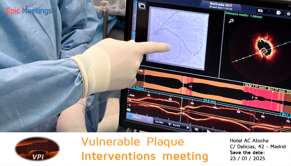🟠Vulnerable Plaque Interventions meeting

📍Location: Hotel AC Atocha C/ Delicias, 42 – Madrid
🗓Date: 23-JAN-2025

✚Registration form: fundacionepic.org/vpi25/

👨🏻‍⚕️Join us for the first Vulnerable Plaque Interventions meeting with an extraordinary well-known international