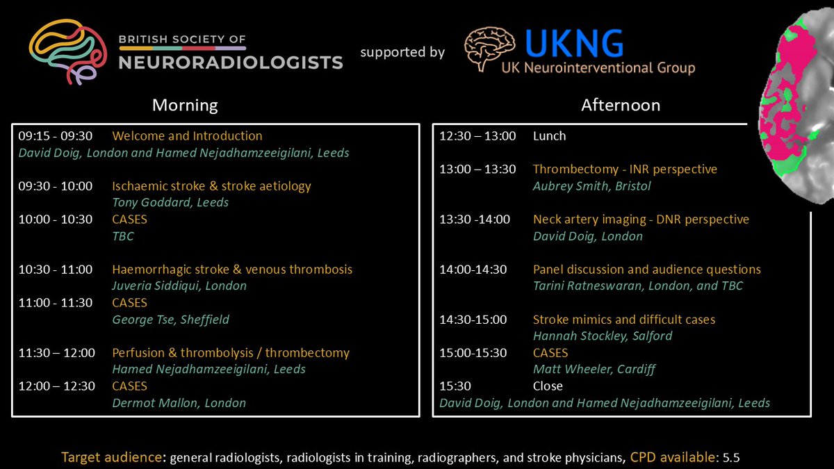 We are very pleased to announce our first online Stroke Imaging Day!   

A fantastic lineup of speakers and interactive cases, of interest to anyone involved in acute stroke care.   

⏲️ 31st January 2025 
💷£50-150
✅Register here: bsnr.org.uk/event/bsnr-onl…

#stroke #neurorad