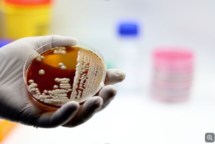 INESC-ID (@inescid) on Twitter photo 🧫💻 INESC-ID coordinates FAIRY project, funded by OSCARS, a new #HorizonEurope Grant, aiming to enhance YEASTRACT+, a platform by ELIXIR, whose Portuguese node is hosted at <a href="/BioDataPT/">BioData.pt</a>. Know more about it! 👉lnkd.in/dKJ-usnR #Yeast #Bioeconomy #GeneResearch #INESCID 🧫💻 INESC-ID coordinates FAIRY project, funded by OSCARS, a new #HorizonEurope Grant, aiming to enhance YEASTRACT+, a platform by ELIXIR, whose Portuguese node is hosted at <a href="/BioDataPT/">BioData.pt</a>. Know more about it! 👉lnkd.in/dKJ-usnR #Yeast #Bioeconomy #GeneResearch #INESCID