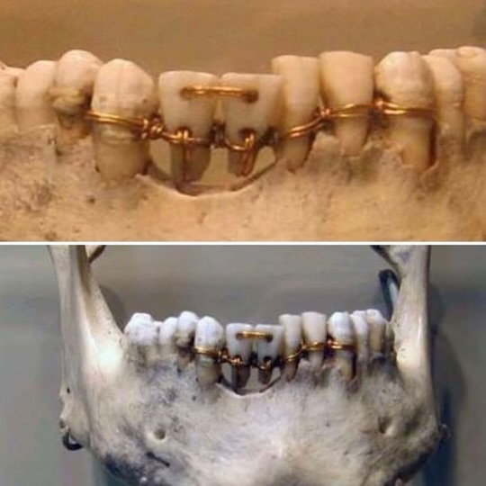 El Eterno Misterio Oculto del Pasado —– Hilo🧵

1. Trabajos dentales del Antiguo Egipto del año 2000a.C. En muchos casos, estos procedimientos se realizaban después de la muerte para asegurarse de que fueran enviados correctamente al más allá.