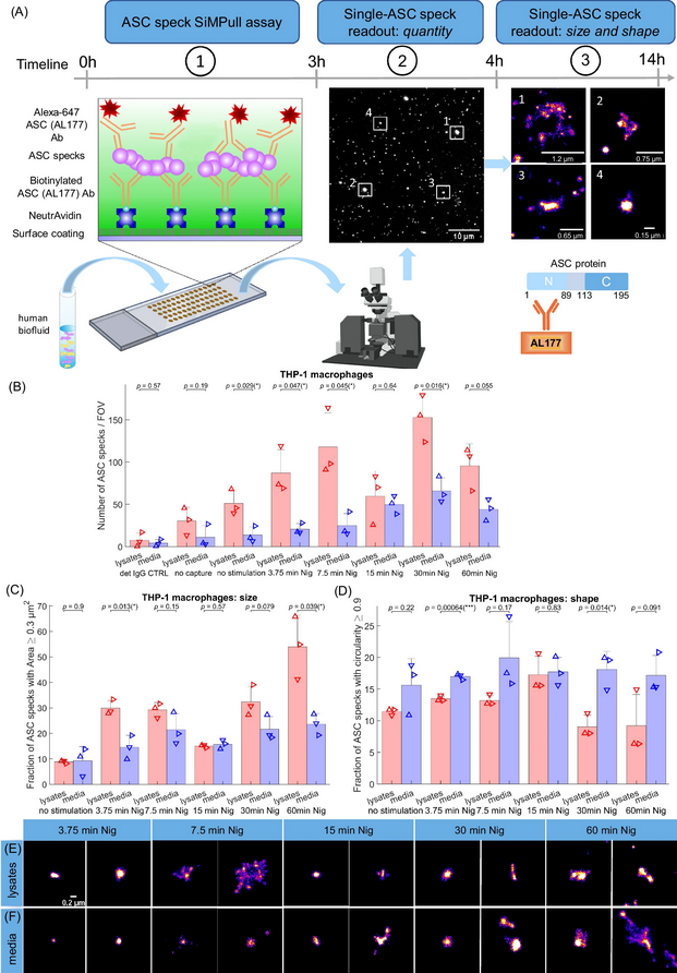 The Science of Parkinson's (@scienceofpd) on Twitter photo Interesting: <a href="/KlenermanLab/">KlenermanLab</a> et al establish an ultra-sensitive single-molecule pull-down immunoassay combined with dSTORM microscopy assayed human post-mortem brain, serum & CSF of #Parkinsons, #Alzheimers & elderly individuals for inflammasome ASC specks
nature.com/articles/s4146⦠Interesting: <a href="/KlenermanLab/">KlenermanLab</a> et al establish an ultra-sensitive single-molecule pull-down immunoassay combined with dSTORM microscopy assayed human post-mortem brain, serum & CSF of #Parkinsons, #Alzheimers & elderly individuals for inflammasome ASC specks
nature.com/articles/s4146ā¦